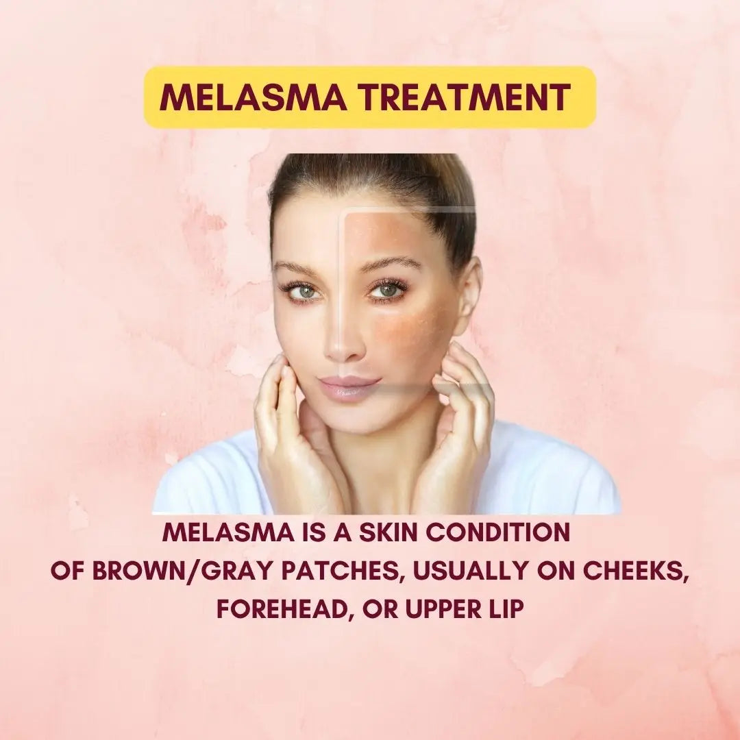 Melasma Treatment Pack - 3 in 1 Velours